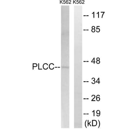 Western Blot - Anti-AGPAT3 Antibody (C14008) - Antibodies.com