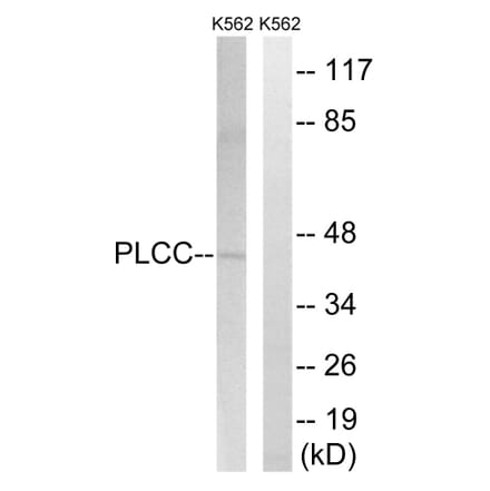 Western Blot - Anti-AGPAT3 Antibody (C14008) - Antibodies.com