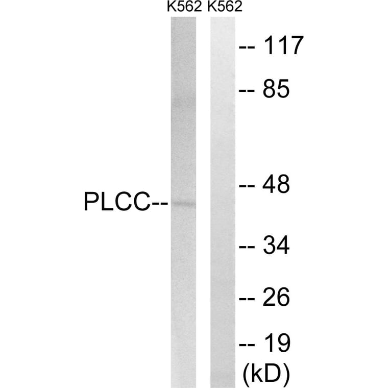 Western Blot - Anti-AGPAT3 Antibody (C14008) - Antibodies.com
