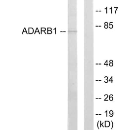 Western Blot - Anti-ADARB1 Antibody (C10800) - Antibodies.com
