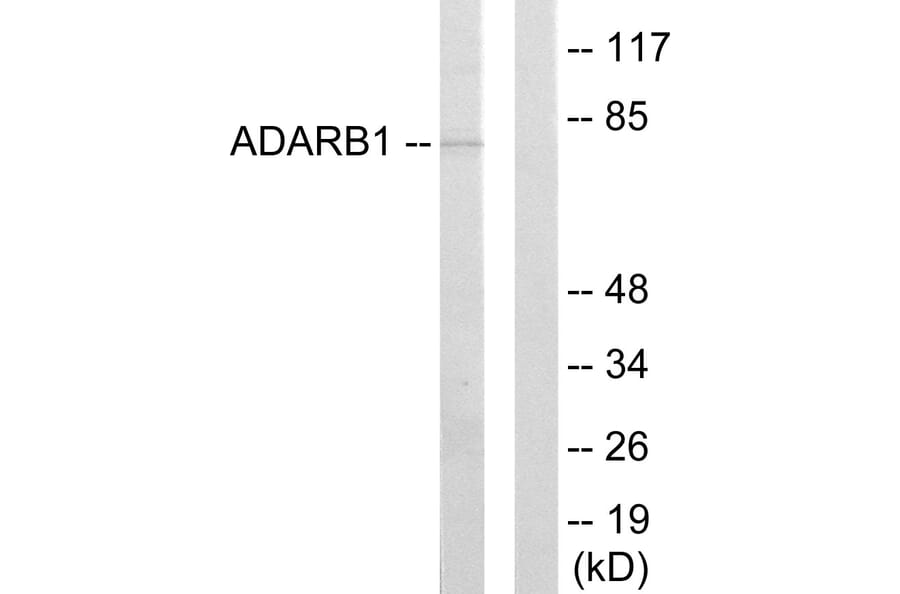 Western Blot - Anti-ADARB1 Antibody (C10800) - Antibodies.com