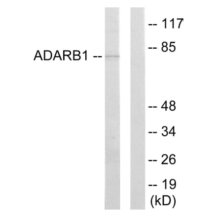 Western Blot - Anti-ADARB1 Antibody (C10800) - Antibodies.com