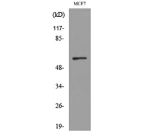 Western Blot - Anti-ACVRL1 Antibody (C30105) - Antibodies.com
