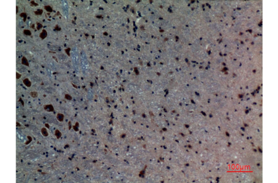 Immunohistochemistry - Anti-ACVRL1 Antibody (C30105) - Antibodies.com