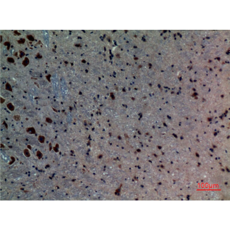 Immunohistochemistry - Anti-ACVRL1 Antibody (C30105) - Antibodies.com