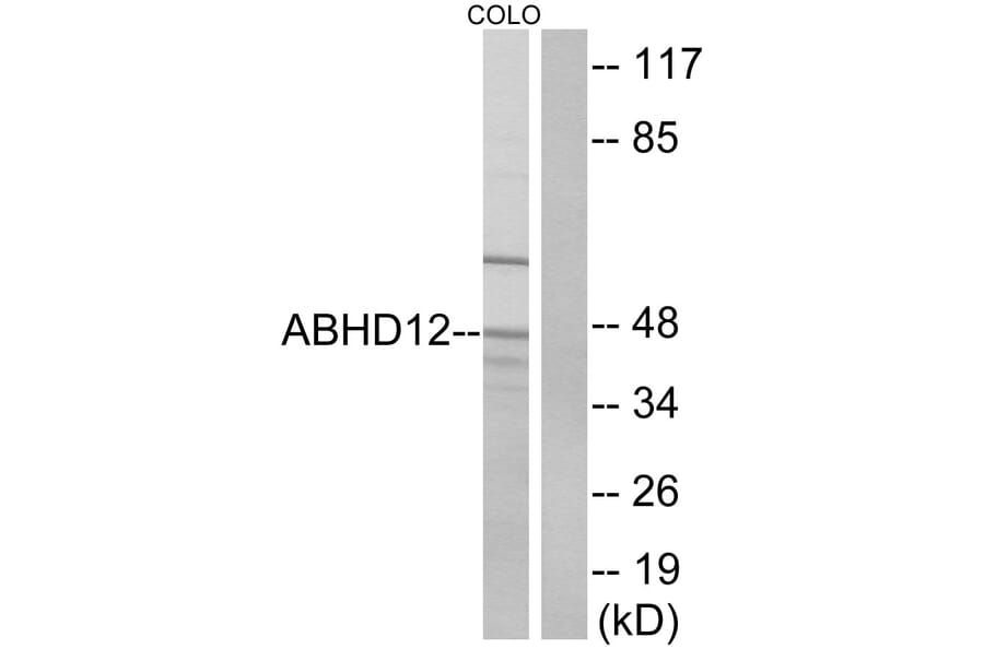 Western Blot - Anti-ABHD12 Antibody (C14209) - Antibodies.com