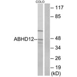Western Blot - Anti-ABHD12 Antibody (C14209) - Antibodies.com