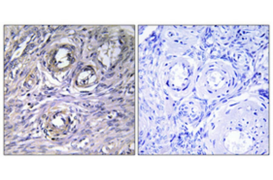 Immunohistochemistry - Anti-ABHD12 Antibody (C14209) - Antibodies.com