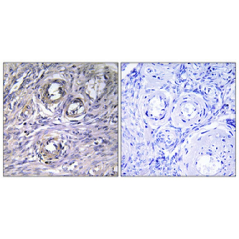 Immunohistochemistry - Anti-ABHD12 Antibody (C14209) - Antibodies.com