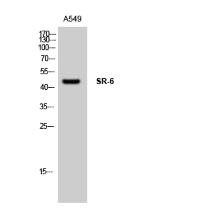 Western Blot - Anti-5-HT-6 Antibody (C12019) - Antibodies.com