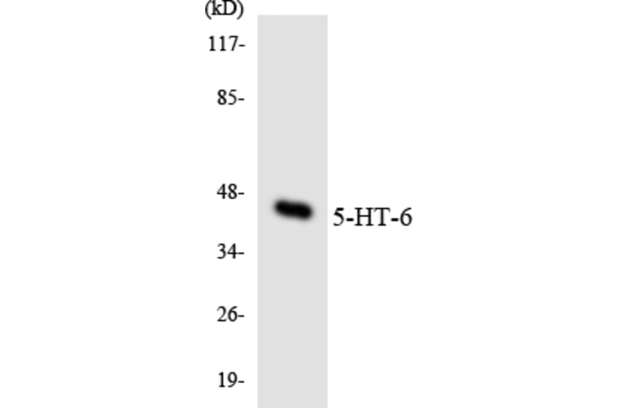 Western Blot - Anti-5-HT-6 Antibody (R12-2422) - Antibodies.com