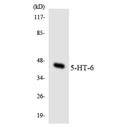 Western Blot - Anti-5-HT-6 Antibody (R12-2422) - Antibodies.com