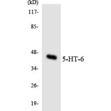 Western Blot - Anti-5-HT-6 Antibody (R12-2422) - Antibodies.com
