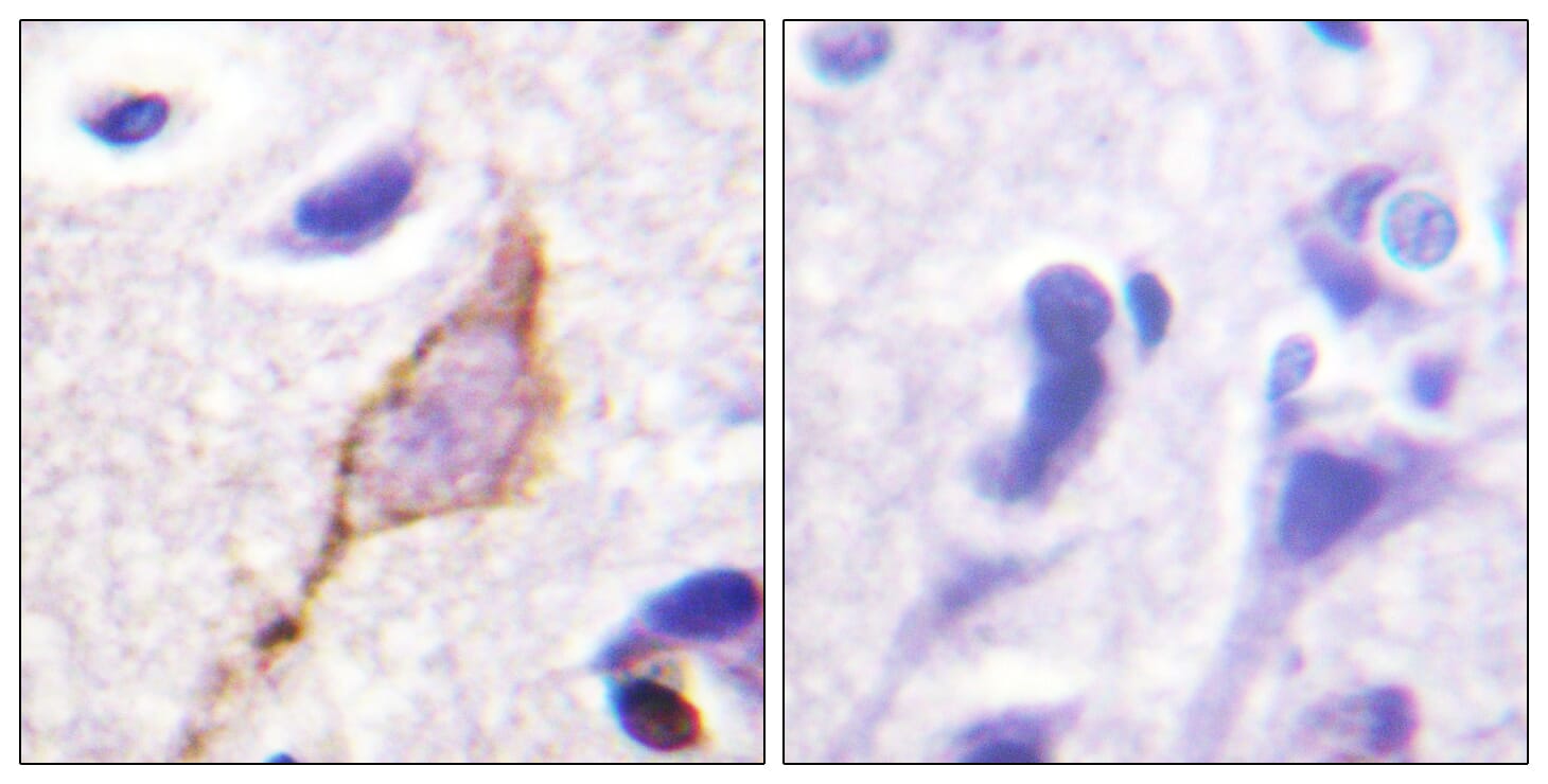 Immunohistochemical analysis of paraffin-embedded human brain tissue using Anti-KCNQ3 Antibody. The right hand panel represents a negative control, where the antibody was pre-incubated with the immunising peptide.