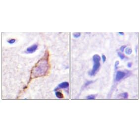 Immunohistochemistry - Anti-KCNQ3 Antibody (B1089) - Antibodies.com