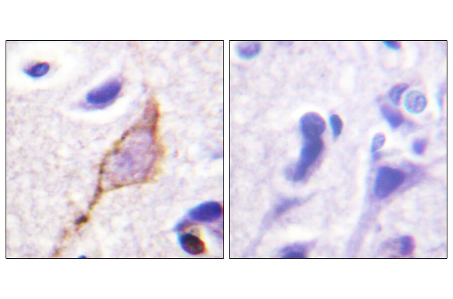 Immunohistochemistry - Anti-KCNQ3 Antibody (B1089) - Antibodies.com