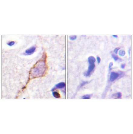 Immunohistochemistry - Anti-KCNQ3 Antibody (B1089) - Antibodies.com