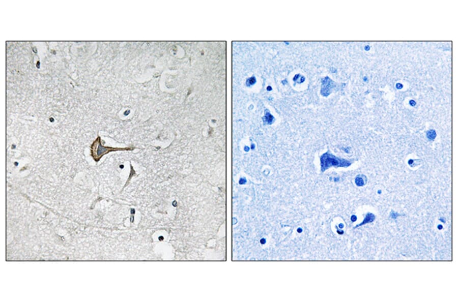 Immunohistochemistry - Anti-KCND2 Antibody (B1088) - Antibodies.com
