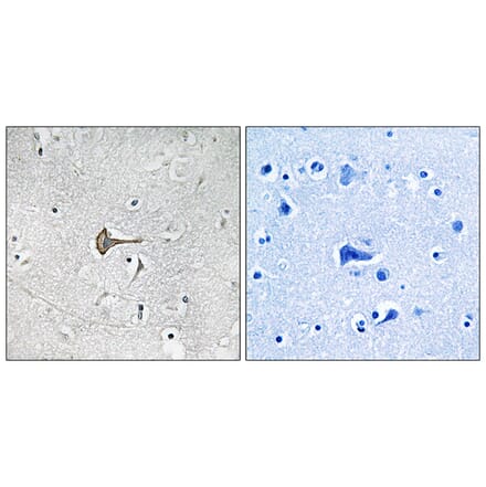 Immunohistochemistry - Anti-KCND2 Antibody (B1088) - Antibodies.com