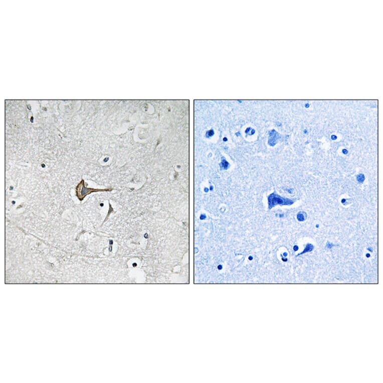 Immunohistochemistry - Anti-KCND2 Antibody (B1088) - Antibodies.com