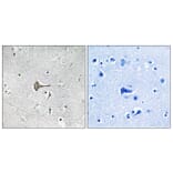 Immunohistochemistry - Anti-KCND2 Antibody (B1088) - Antibodies.com