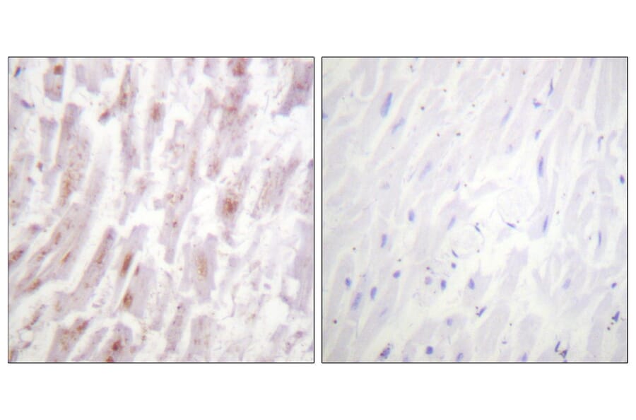 Immunohistochemistry - Anti-CRYAB Antibody (B0896) - Antibodies.com