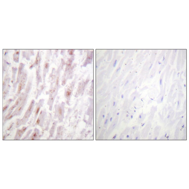 Immunohistochemistry - Anti-CRYAB Antibody (B0896) - Antibodies.com