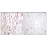 Immunohistochemistry - Anti-CRYAB Antibody (B0896) - Antibodies.com