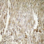 Immunohistochemistry - Anti-CRYAB Antibody (B0896) - Antibodies.com