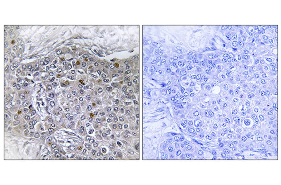 Immunohistochemistry - Anti-ZMY11 Antibody (C11071) - Antibodies.com