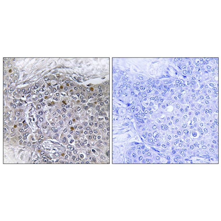 Immunohistochemistry - Anti-ZMY11 Antibody (C11071) - Antibodies.com