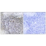 Immunohistochemistry - Anti-ZMY11 Antibody (C11071) - Antibodies.com