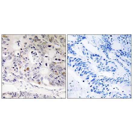Immunohistochemistry - Anti-UBTD1 Antibody (C19406) - Antibodies.com