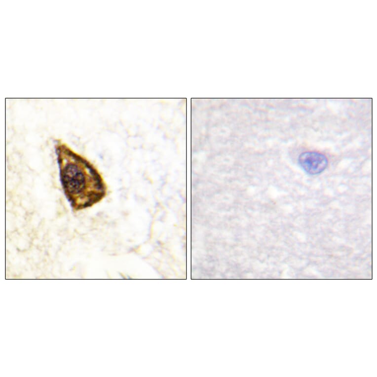 Immunohistochemistry - Anti-Trk B Antibody (B0036) - Antibodies.com