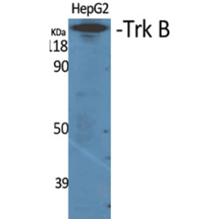 Western Blot - Anti-Trk B Antibody (B0036) - Antibodies.com