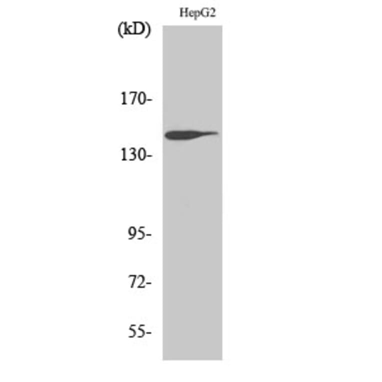 Western Blot - Anti-Trk B Antibody (B0036) - Antibodies.com