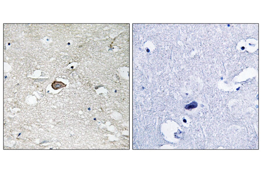 Immunohistochemistry - Anti-Trk A Antibody (B8070) - Antibodies.com
