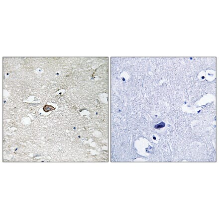 Immunohistochemistry - Anti-Trk A Antibody (B8070) - Antibodies.com