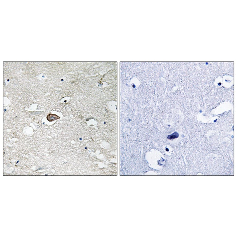 Immunohistochemistry - Anti-Trk A Antibody (B8070) - Antibodies.com