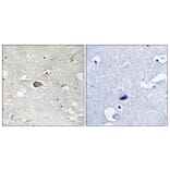 Immunohistochemistry - Anti-Trk A Antibody (B8070) - Antibodies.com