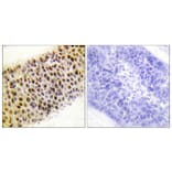 Immunohistochemistry - Anti-TIP60 Antibody (B0814) - Antibodies.com