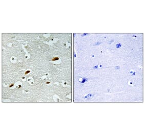 Immunohistochemistry - Anti-TIP60 Antibody (C11451) - Antibodies.com