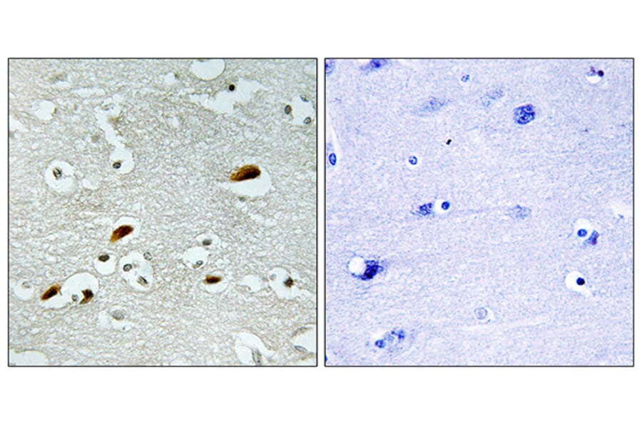 Immunohistochemistry - Anti-TIP60 Antibody (C11451) - Antibodies.com