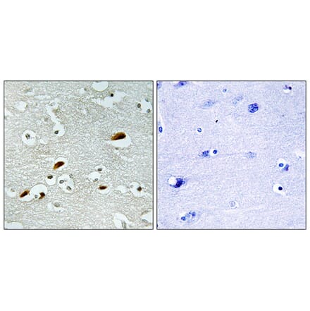 Immunohistochemistry - Anti-TIP60 Antibody (C11451) - Antibodies.com