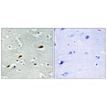 Immunohistochemistry - Anti-TIP60 Antibody (C11451) - Antibodies.com