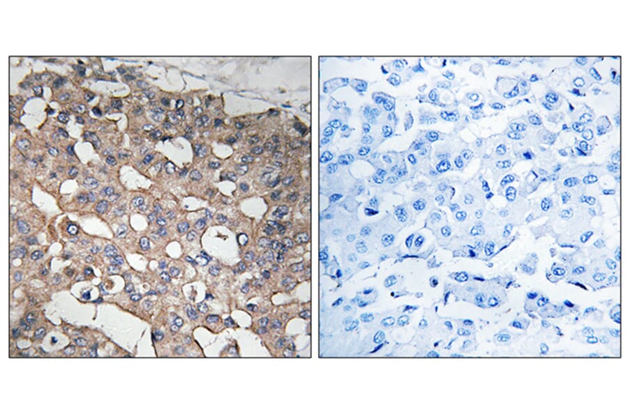 Immunohistochemistry - Anti-STMN1 Antibody (B8066) - Antibodies.com