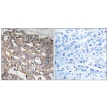 Immunohistochemistry - Anti-STMN1 Antibody (B8066) - Antibodies.com