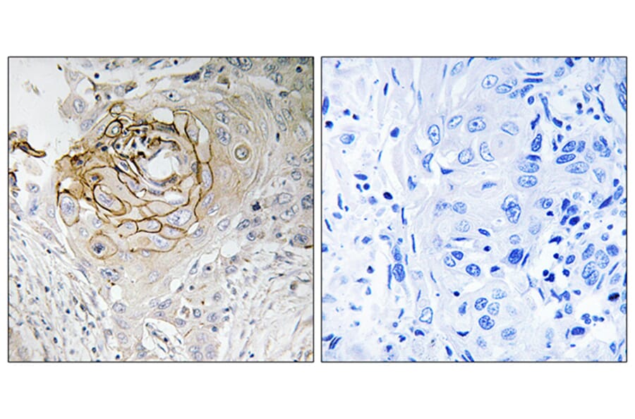 Immunohistochemistry - Anti-SCN9A Antibody (C18819) - Antibodies.com