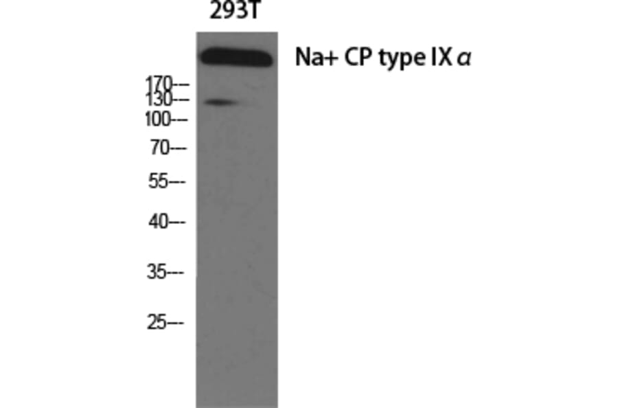 Western Blot - Anti-SCN9A Antibody (C18819) - Antibodies.com