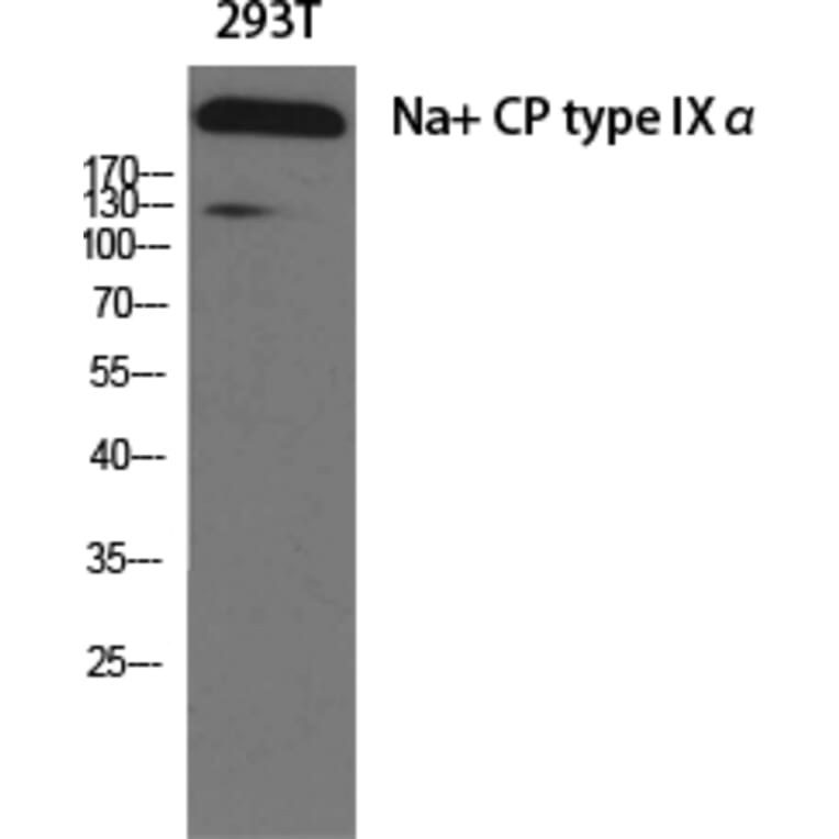 Western Blot - Anti-SCN9A Antibody (C18819) - Antibodies.com